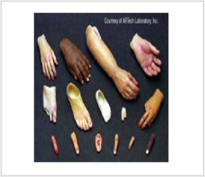 Artificial Limbs & Cosmetic Prosthesi